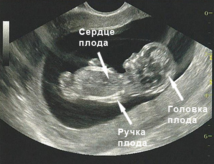 УЗИ во время беременности
